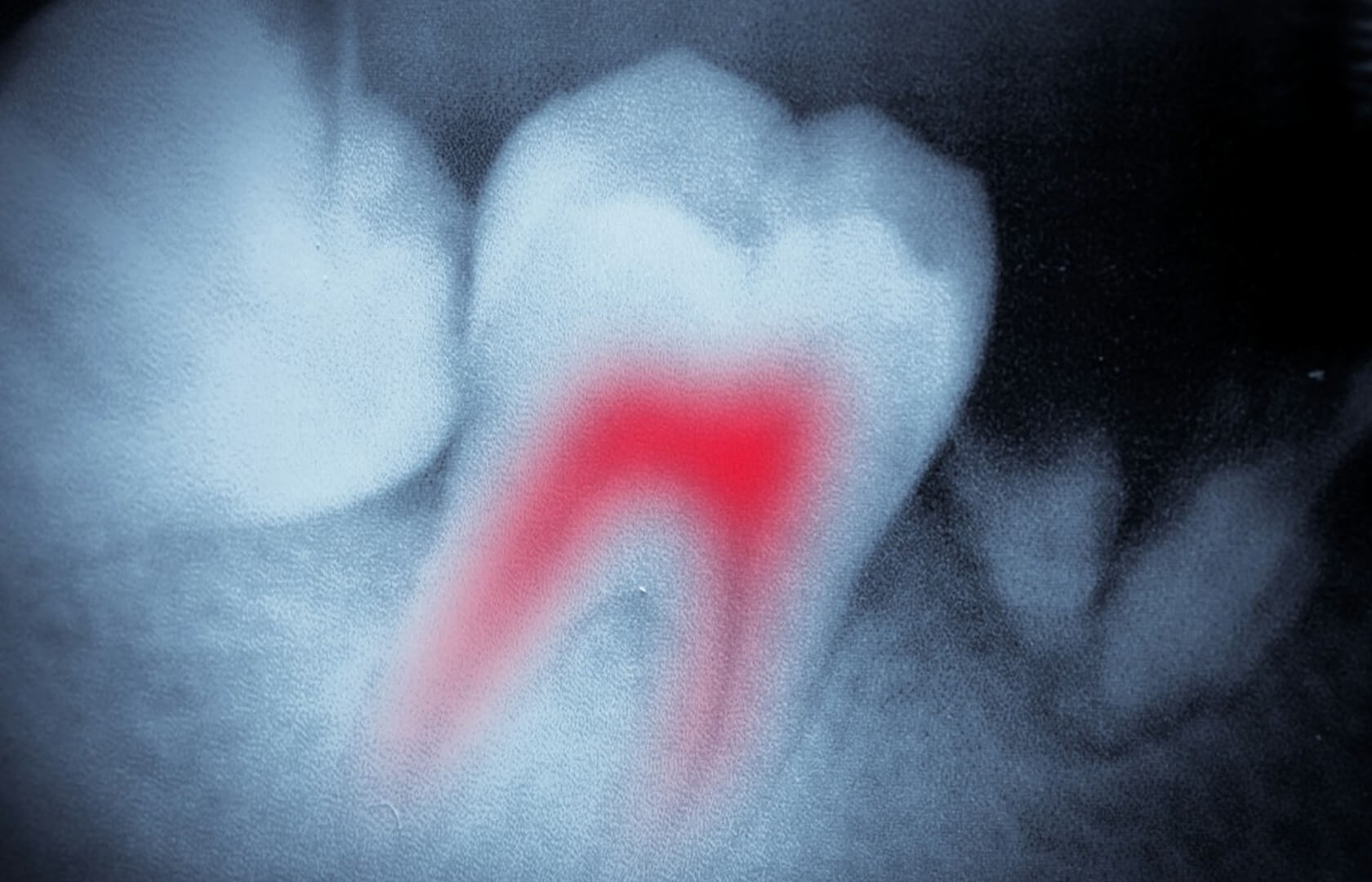 Odeon Dental